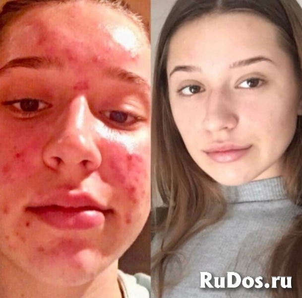 Услуги косметолога изображение 4