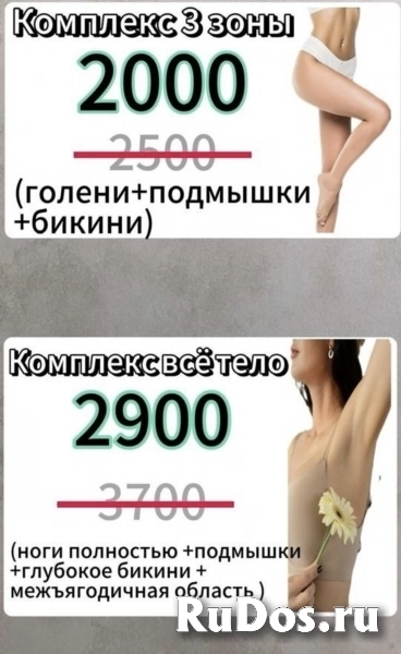 Лазерная эпиляция фотка