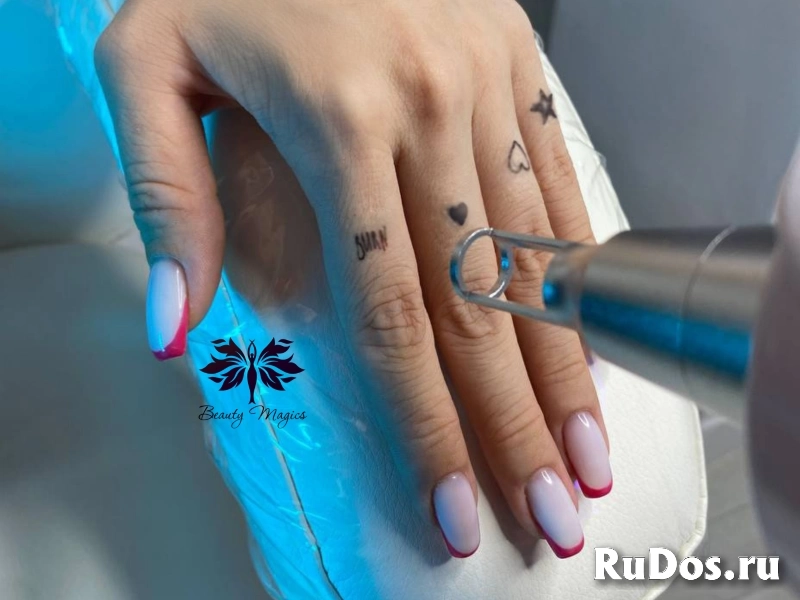 Лазерное удаление тату и перманентного макияжа фото