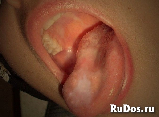 Шикарный МБР и не только изображение 3