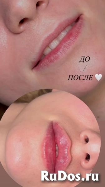 Косметолог Воронеж изображение 5