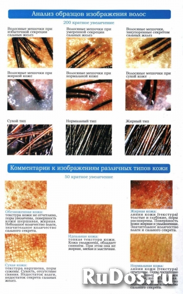 Анализатор состояния кожи тела Healthy Joy. Цена -80%! изображение 8