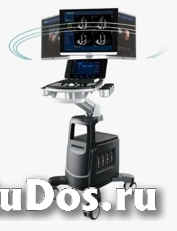 Аппарат ультразвуковой диагностики Chison Qbit 11 изображение 3