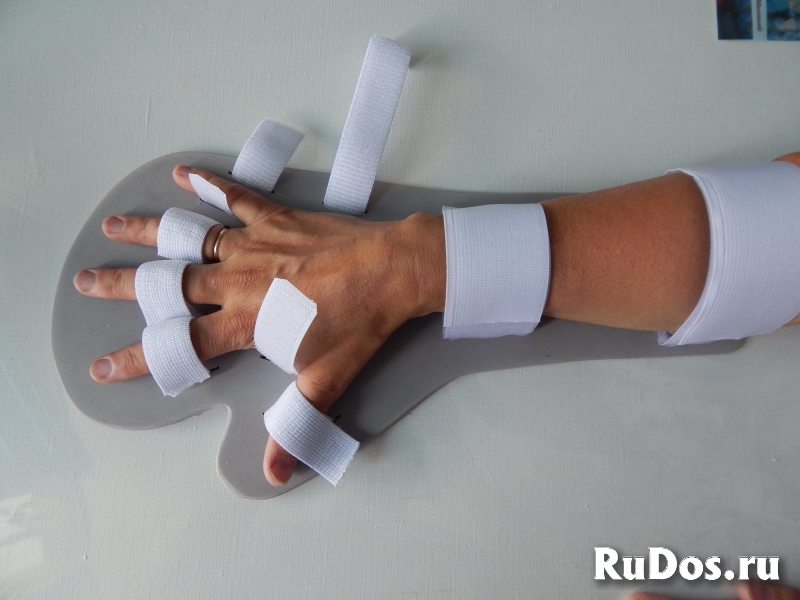 Фиксатор для распрямления пальцев изображение 6