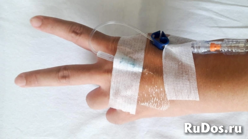 Капельницы на Дому Медсестра быстрый Выезд в Химках Долгопрудный изображение 4