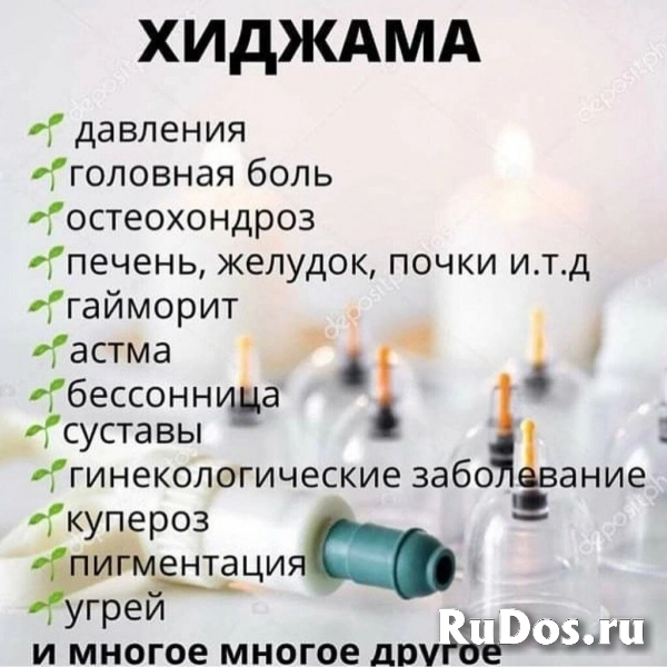 Хиджама на выезд фотка