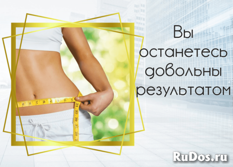 Аппарат нервно-мышечной стимуляции оптом изображение 3