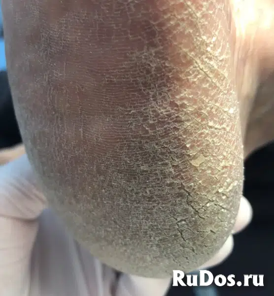 Педикюр, подолог стерлитамак фотка