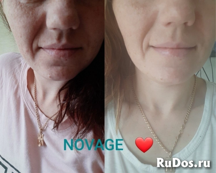 Комплексный уход кожи от пигментации Novage+ Орифлэйм изображение 6