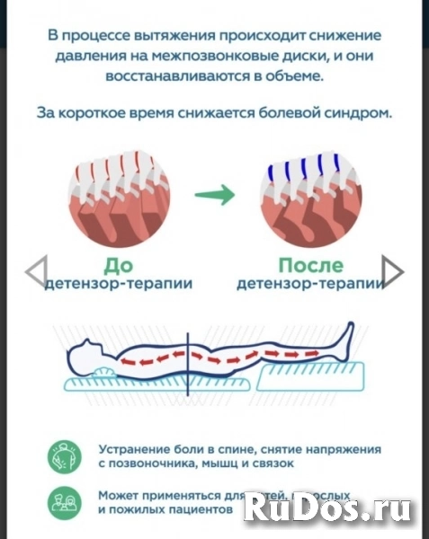 Услуга массаж, тракционный мат. ( бережное вытяжение позвоночника.) изображение 8