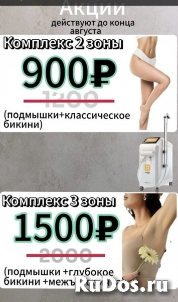 Лазерная эпиляция фото