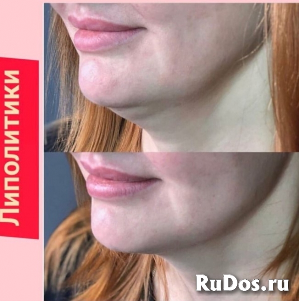 Услуги косметолога изображение 3