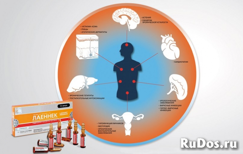 Капельницы на Дому в Химках Сервис InDoctor Медсестра на Дом изображение 9