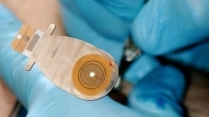 Замена Калоприемника Выезд Медсестры на Дом Химки Долгопрудный картинка из объявления