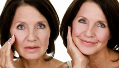 Бесплатная процедура омоложения лица картинка из объявления