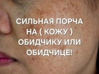 ЧЁРНАЯ МАГИЯ! ПОРЧА ( НА КОЖУ ОБИДЧИКУ ИЛИ ОБИДЧИЦЕ )! ЖАБЬЯ ПОРЧА!